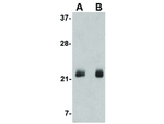 FGF4 Antibody in Western Blot (WB)