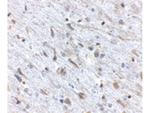 FKBP15 Antibody in Immunohistochemistry (Paraffin) (IHC (P))