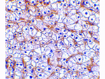 FN14 Antibody in Immunohistochemistry (Paraffin) (IHC (P))