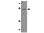 FOXG1 Antibody in Western Blot (WB)