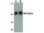 FOXO4 Antibody in Western Blot (WB)