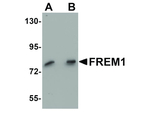 FREM1 Antibody in Western Blot (WB)