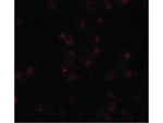 FREM2 Antibody in Immunocytochemistry (ICC/IF)