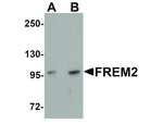 FREM2 Antibody in Western Blot (WB)