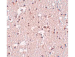 FRMPD3 Antibody in Immunohistochemistry (Paraffin) (IHC (P))