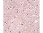 FRMPD4 Antibody in Immunohistochemistry (Paraffin) (IHC (P))