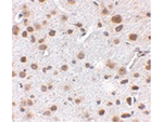 FTO Antibody in Immunohistochemistry (Paraffin) (IHC (P))