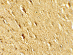 GABARAPL2 Antibody in Immunohistochemistry (Paraffin) (IHC (P))