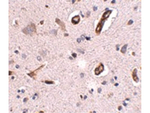 GALNT10 Antibody in Immunohistochemistry (Paraffin) (IHC (P))