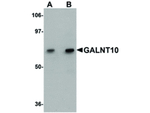 GALNT10 Antibody in Western Blot (WB)