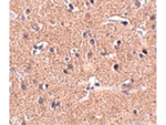 GALNT10 Antibody in Immunohistochemistry (Paraffin) (IHC (P))