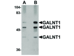 GALNT10 Antibody in Western Blot (WB)