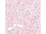 GATA3 Antibody in Immunohistochemistry (Paraffin) (IHC (P))
