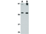GDF6 Polyclonal Antibody
