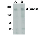 Girdin Antibody in Western Blot (WB)