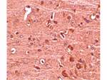 GLE1 Antibody in Immunohistochemistry (Paraffin) (IHC (P))