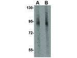 GLE1 Antibody in Western Blot (WB)