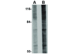 GLE1 Antibody in Western Blot (WB)