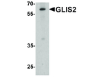 GLIS2 Polyclonal Antibody