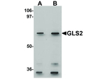 GLS2 Antibody in Western Blot (WB)