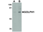 GOLPH1 Polyclonal Antibody