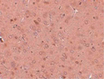 GOLPH2 Antibody in Immunohistochemistry (Paraffin) (IHC (P))