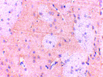 GPAT1 Antibody in Immunohistochemistry (Paraffin) (IHC (P))