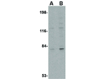 GPAT1 Antibody in Western Blot (WB)