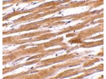 GPVI Antibody in Immunohistochemistry (Paraffin) (IHC (P))