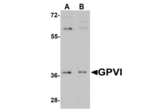 GPVI Antibody in Western Blot (WB)