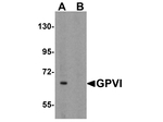 GPVI Antibody in Western Blot (WB)