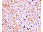 GRIK1 Antibody in Immunohistochemistry (Paraffin) (IHC (P))