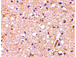 GRIK1 Antibody in Immunohistochemistry (Paraffin) (IHC (P))
