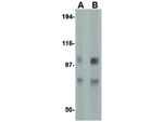GRIK1 Antibody in Western Blot (WB)