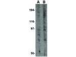 GRIK3 Polyclonal Antibody