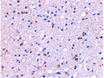 GRIK4 Antibody in Immunohistochemistry (Paraffin) (IHC (P))