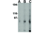 GRIK4 Antibody in Western Blot (WB)