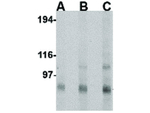 GRIK4 Antibody in Western Blot (WB)
