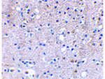 GRIK5 Antibody in Immunohistochemistry (Paraffin) (IHC (P))