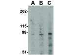 GRIK5 Antibody in Western Blot (WB)