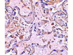 GSTP1 Antibody in Immunohistochemistry (Paraffin) (IHC (P))