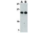 GSTP1 Antibody in Western Blot (WB)