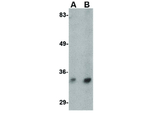 Hax1b Polyclonal Antibody
