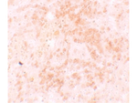 HVCN1 Antibody in Immunohistochemistry (Paraffin) (IHC (P))