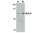 IA6 Polyclonal Antibody