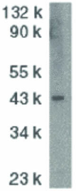 ICAD Antibody in Western Blot (WB)