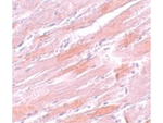 IDH2 Antibody in Immunohistochemistry (Paraffin) (IHC (P))