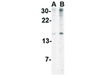IEX1 Antibody in Western Blot (WB)