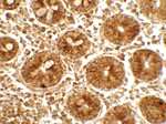 IFIT1 Antibody in Immunohistochemistry (Paraffin) (IHC (P))