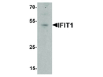 IFIT1 Antibody in Western Blot (WB)